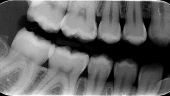 Image radiologique